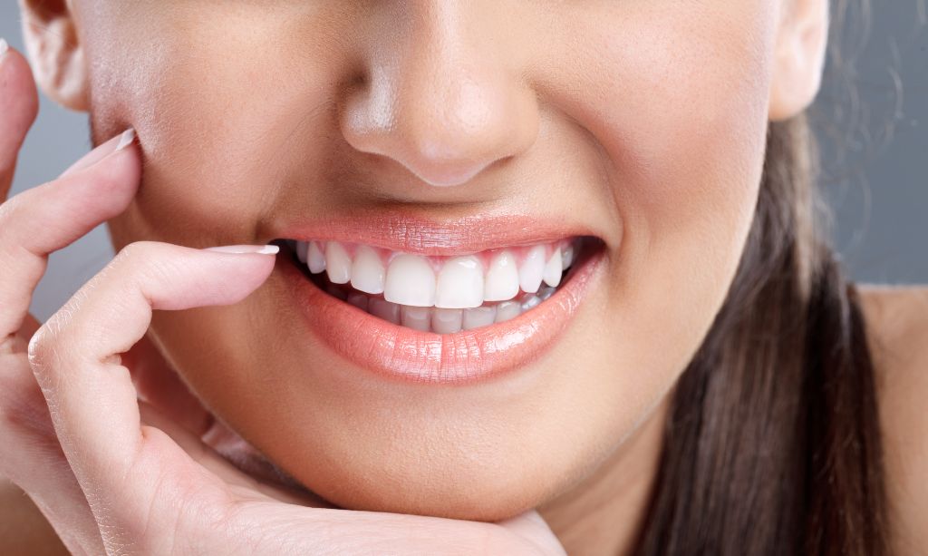Can I Whiten My Lumineers?