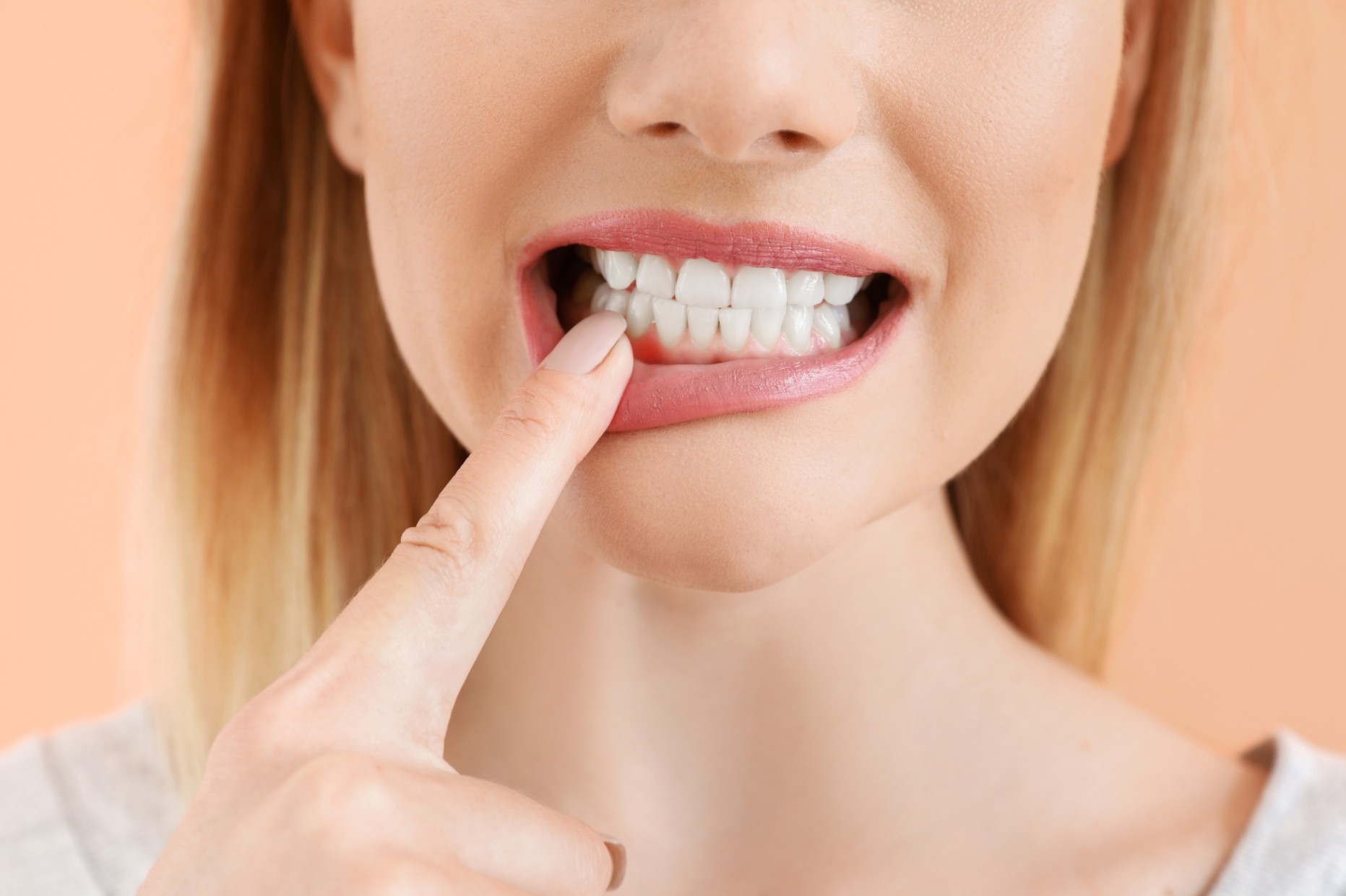 Dental implants on Groupon – too good to be true?