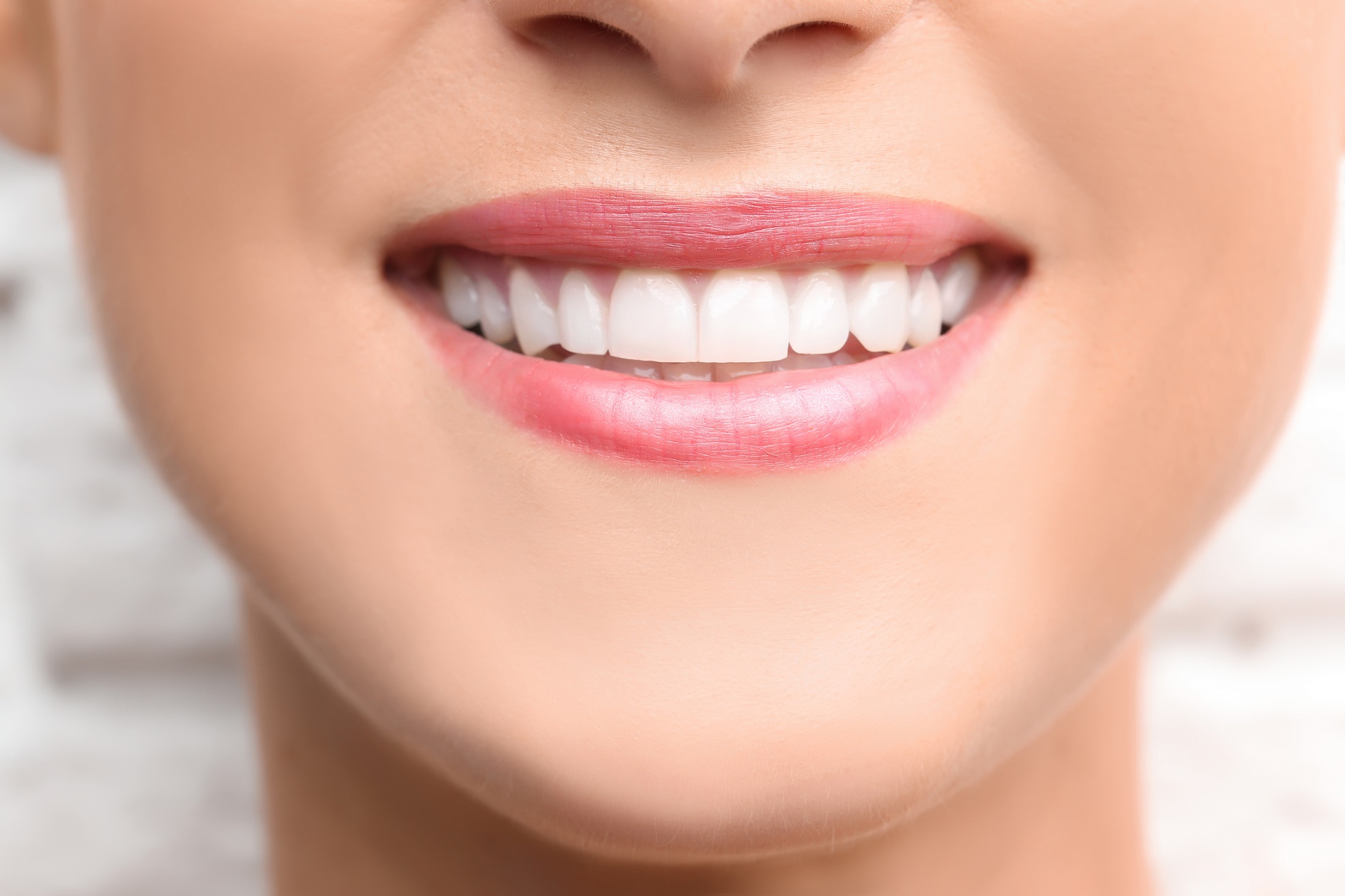 I ruined my dental bonding!