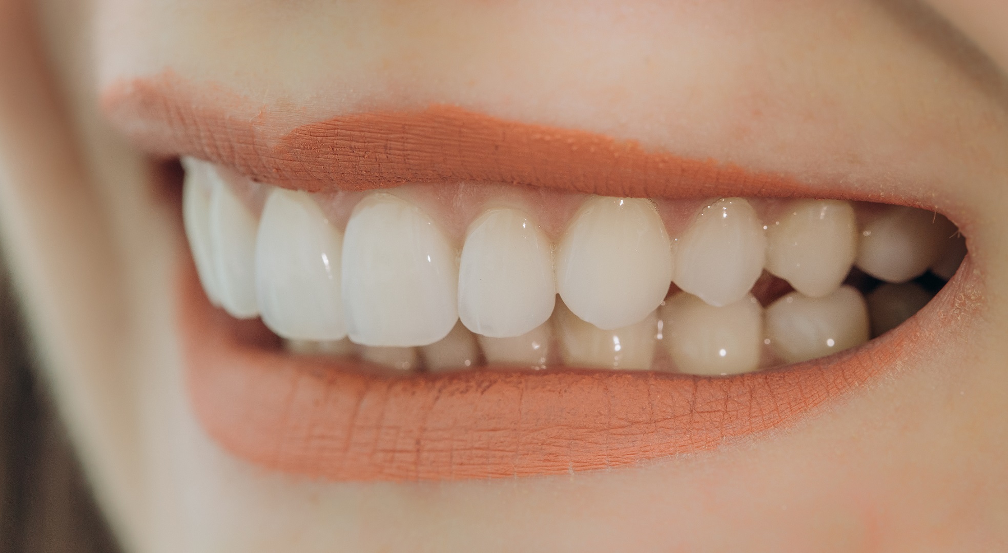 Is a digital smile makeover legit?