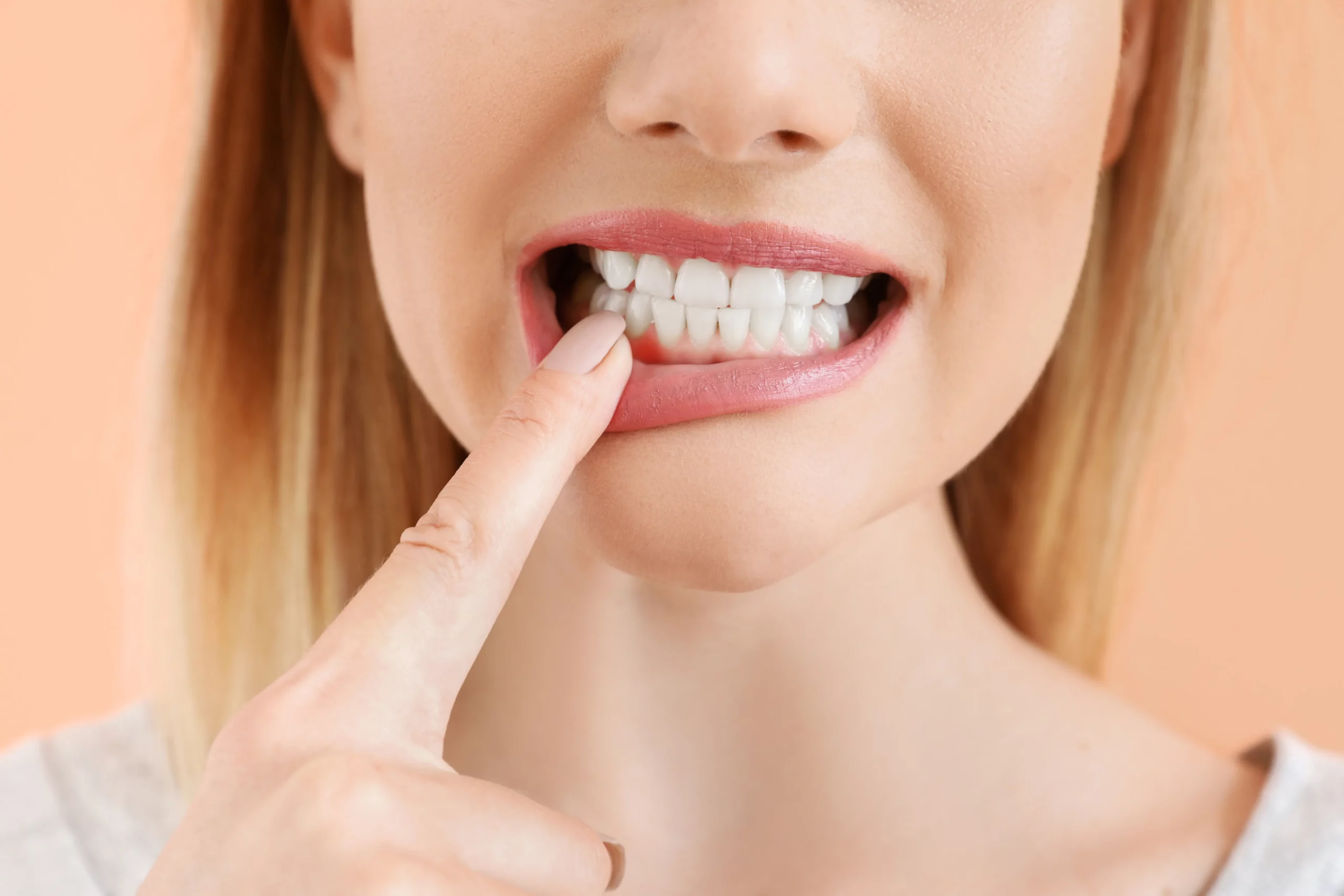 Bleeding Gums After Your 6-Month Cleaning?