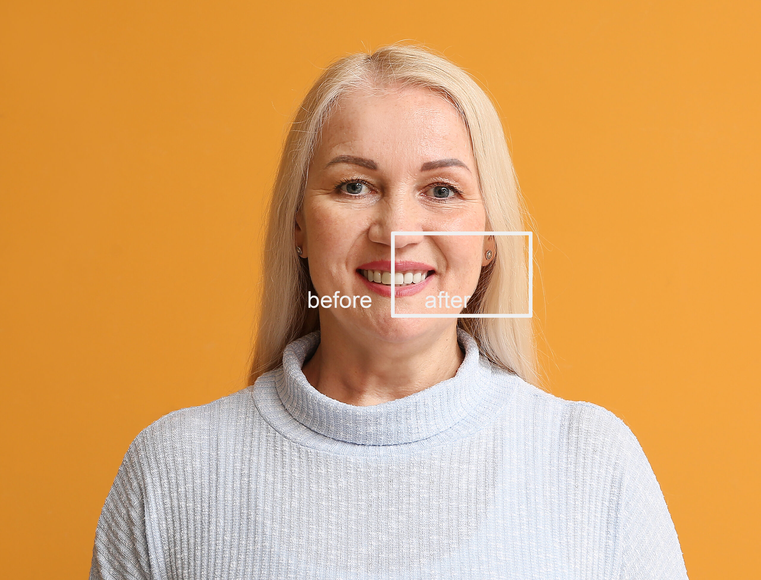 Brighten Your Smile with Dental Bonding at Coleman Dental
