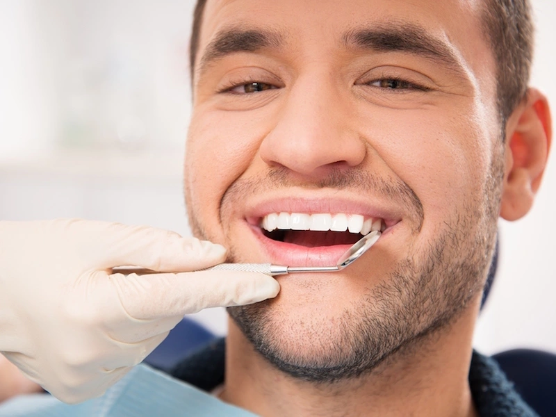 Dental Veneers: 7 Fast Fixes