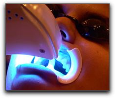 Affordable Tooth Whitening